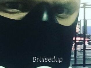 Bruisedup
